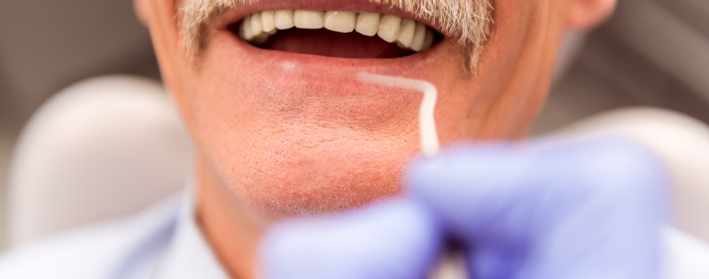Diabetes y salud dental, cómo cuidar las encías